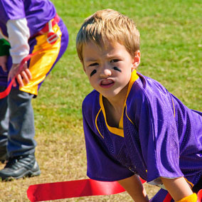 mouthguards